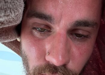 Justin Bieber posts about detoxing

https://www.instagram.com/p/DLxYHB4IK2B/?img_index=5

7/6/25